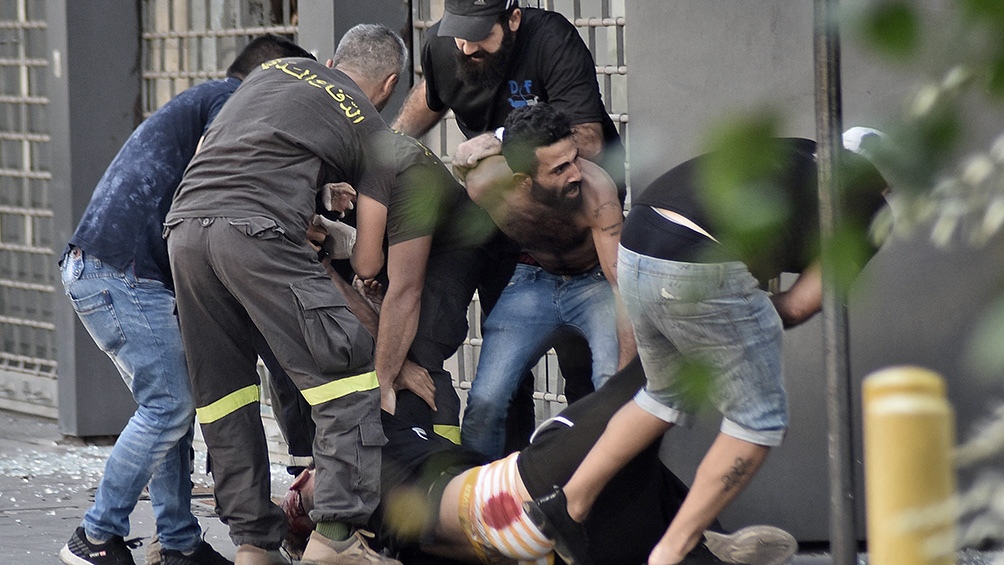 En total, 30 personas resultaron heridas, según la Cruz Roja. Foto: AFP