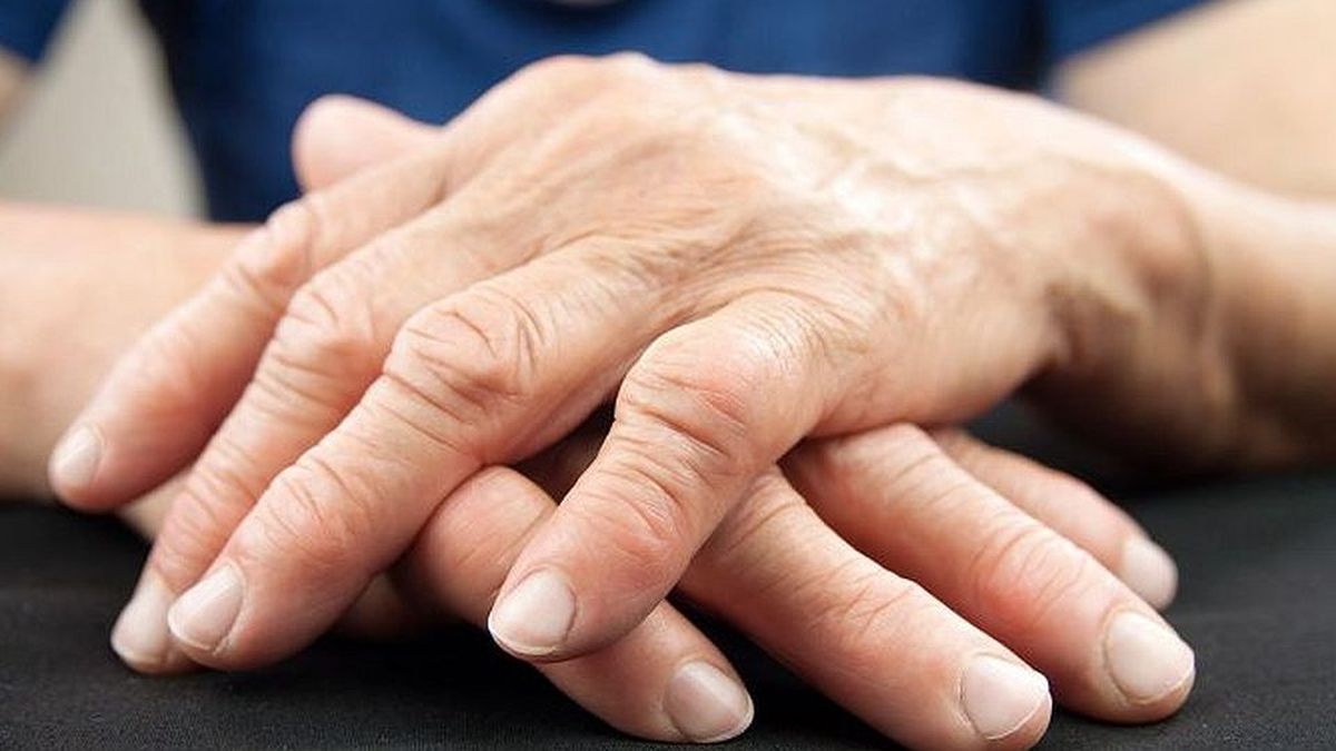 Decisión compartida con pacientes en el tratamiento de artritis psoriásica para lograr la remisión