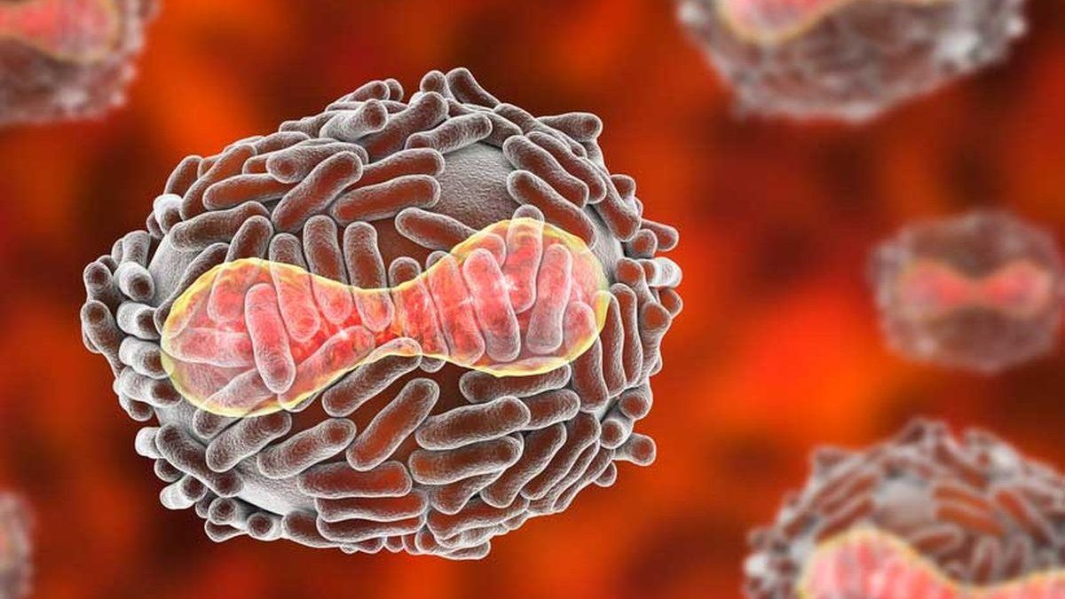 Viruela del mono: Bélgica encendió las alarmas y decretó la cuarentena obligatoria