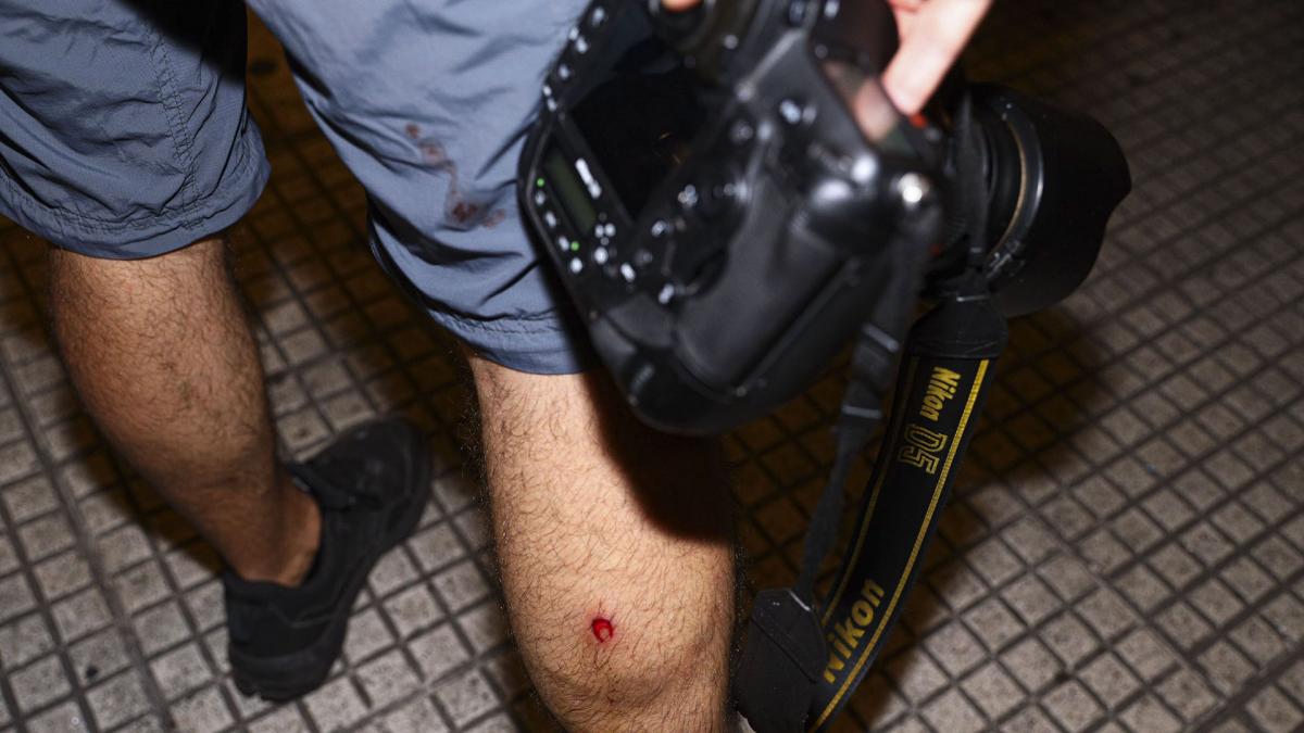 Varios periodistas resultaron heridos con balas de goma este jueves afuera del Congreso