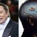 Blindsight: cómo es el chip cerebral con el que Elon Musk promete restaurar la visión a personas ciegas