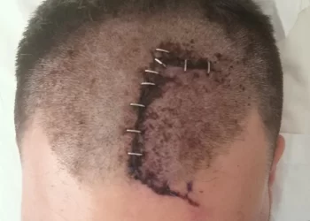 La lenta recuperación de J. tras una salvaje agresión por ser policía: «Mi día a día es estar en casa, en el sofá»>