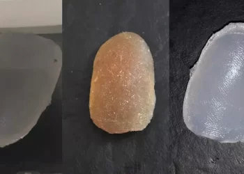 En medio de paros y huelgas en Aerolíneas se esperan definiciones por la causa de los dedos de goma