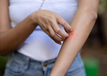 Sin dengue: cuál es el único país donde no existen los mosquitos