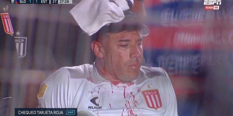 Video: el planchazo de Irala que le cortó la cabeza a Mansilla