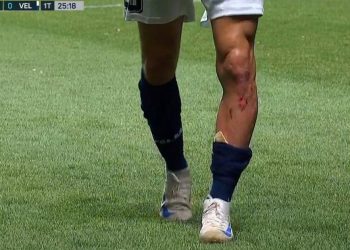 Video: la patada que sacó a Pizzini de la cancha durante cuatro minutos