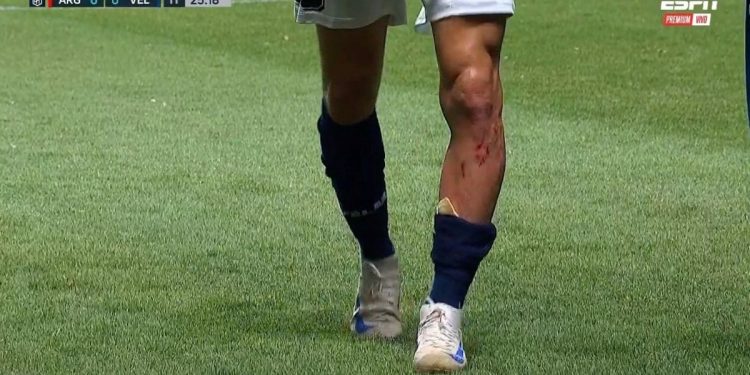 Video: la patada que sacó a Pizzini de la cancha durante cuatro minutos