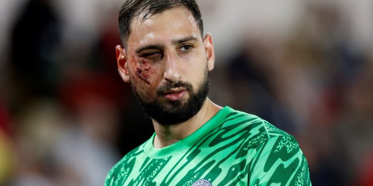 El terrible planchazo en la cara que recibió Donnarumma en Monaco vs. PSG