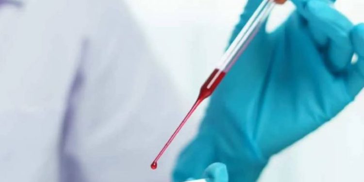 ¿Tenés este grupo sanguíneo? Un estudio reveló que tardarás en envejecer