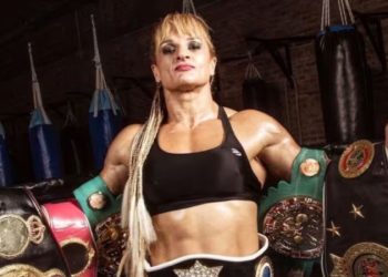 El último parte médico de Alejandra “Locomotora” Oliveras después de ser operada por un ACV