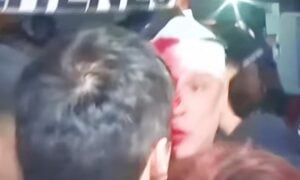 Periodista herido acto Milei