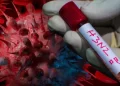 Confirman la primera muerte por super gripe H3N2 y se duplican los casos en el país