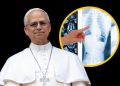 León XIV, rumbo al quirófano: el Papa salió del Vaticano hacia el Gemelli para una operación pulmonar
