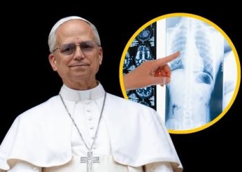 León XIV, rumbo al quirófano: el Papa salió del Vaticano hacia el Gemelli para una operación pulmonar