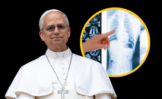 León XIV, rumbo al quirófano: el Papa salió del Vaticano hacia el Gemelli para una operación pulmonar